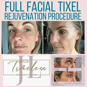 FULL TIXEL REJUVINATION PROCEDURE (3 SESSIONS)