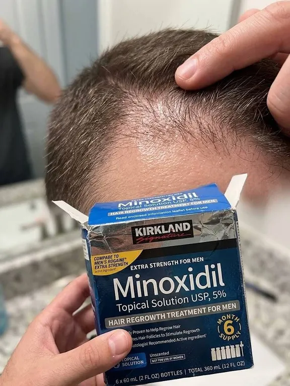 Kirkland Signature Minoxidil 5% Topical Solution