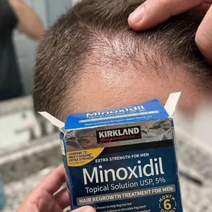 Kirkland Signature Minoxidil 5% Topical Solution