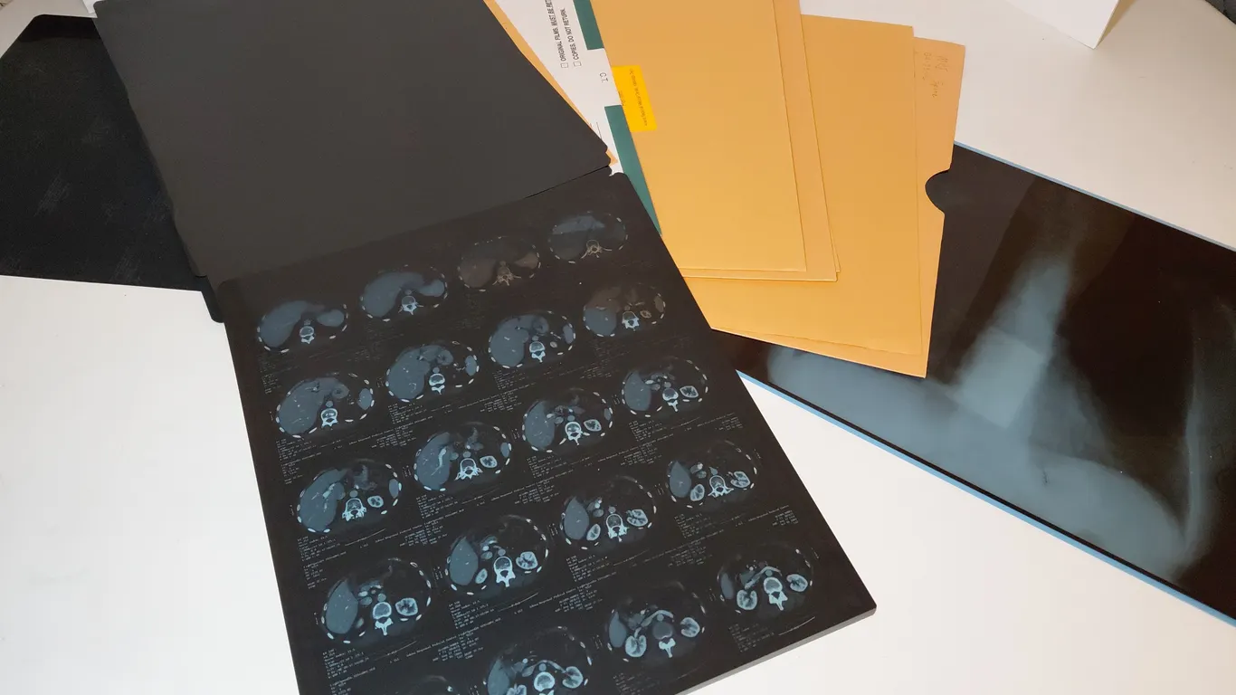 X-Ray And Scan Films