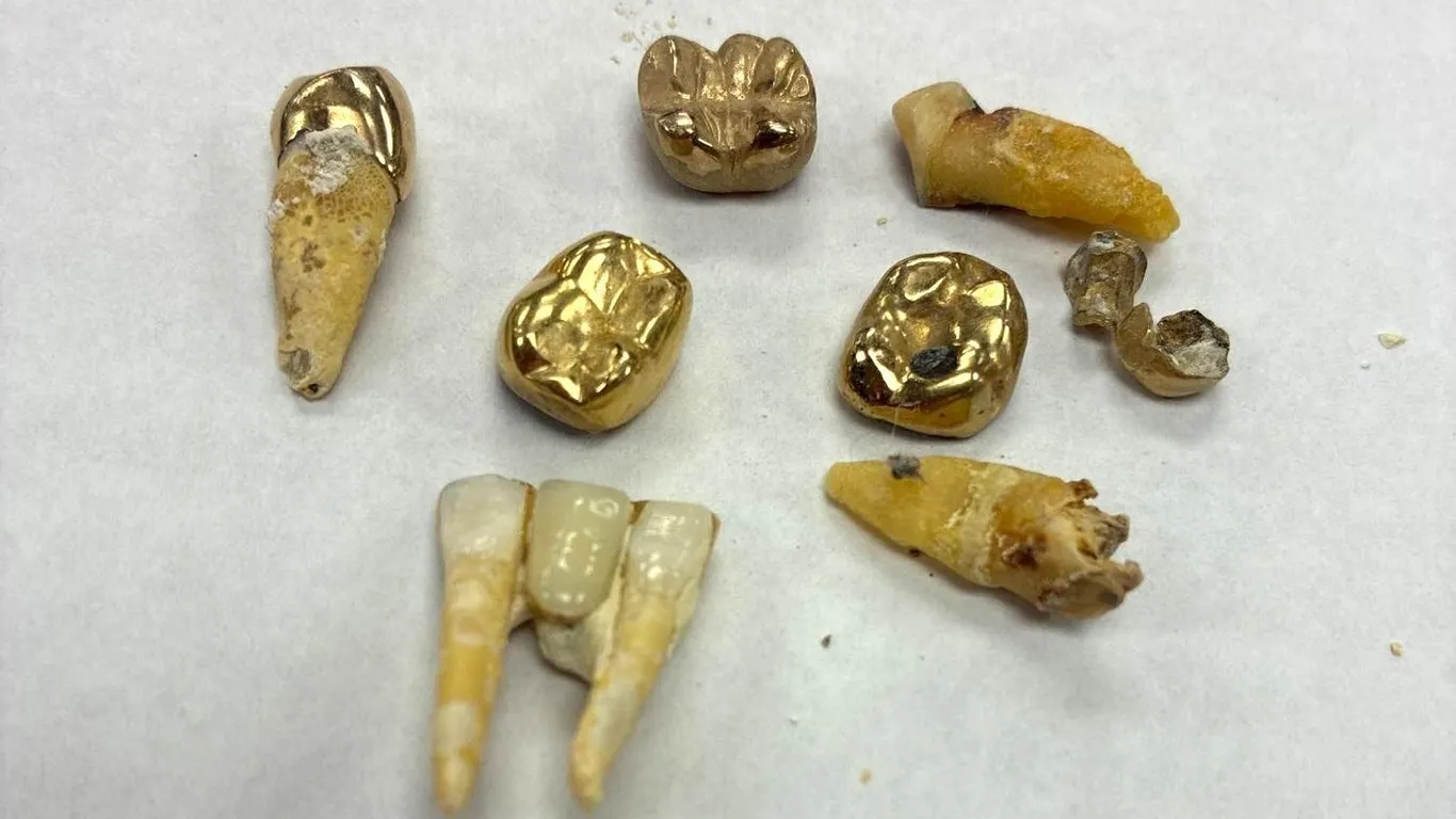 DENTAL GOLD LOT