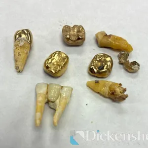 DENTAL GOLD LOT
